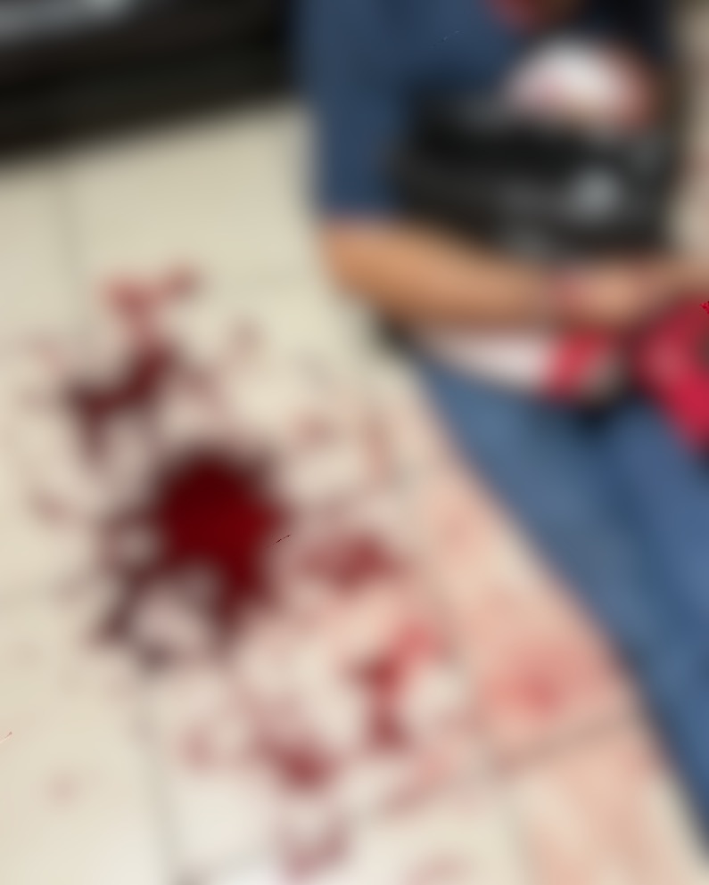 Intento de asesinato a adulto mayor en su propia casa; lo atacan con cuchillo en la Xochicali